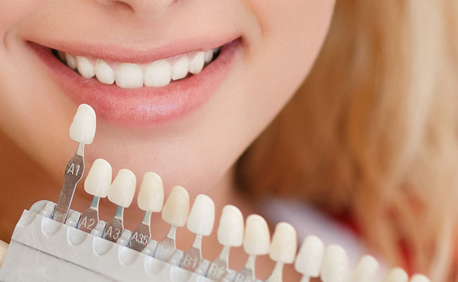 Teeth Whitening
